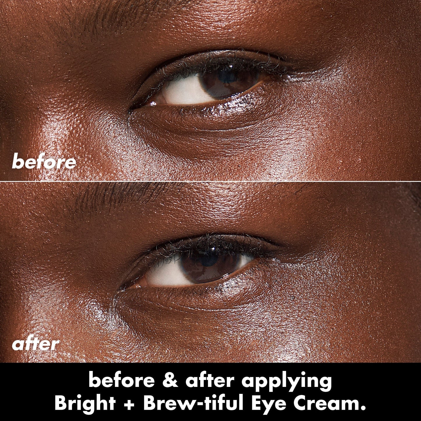 bright-brew-tiful-eye-cream-x7 0226_BBEC_Eye_BA_Diptych_607e3ec2-f0e1-4365-9b28-17574d841250.jpg