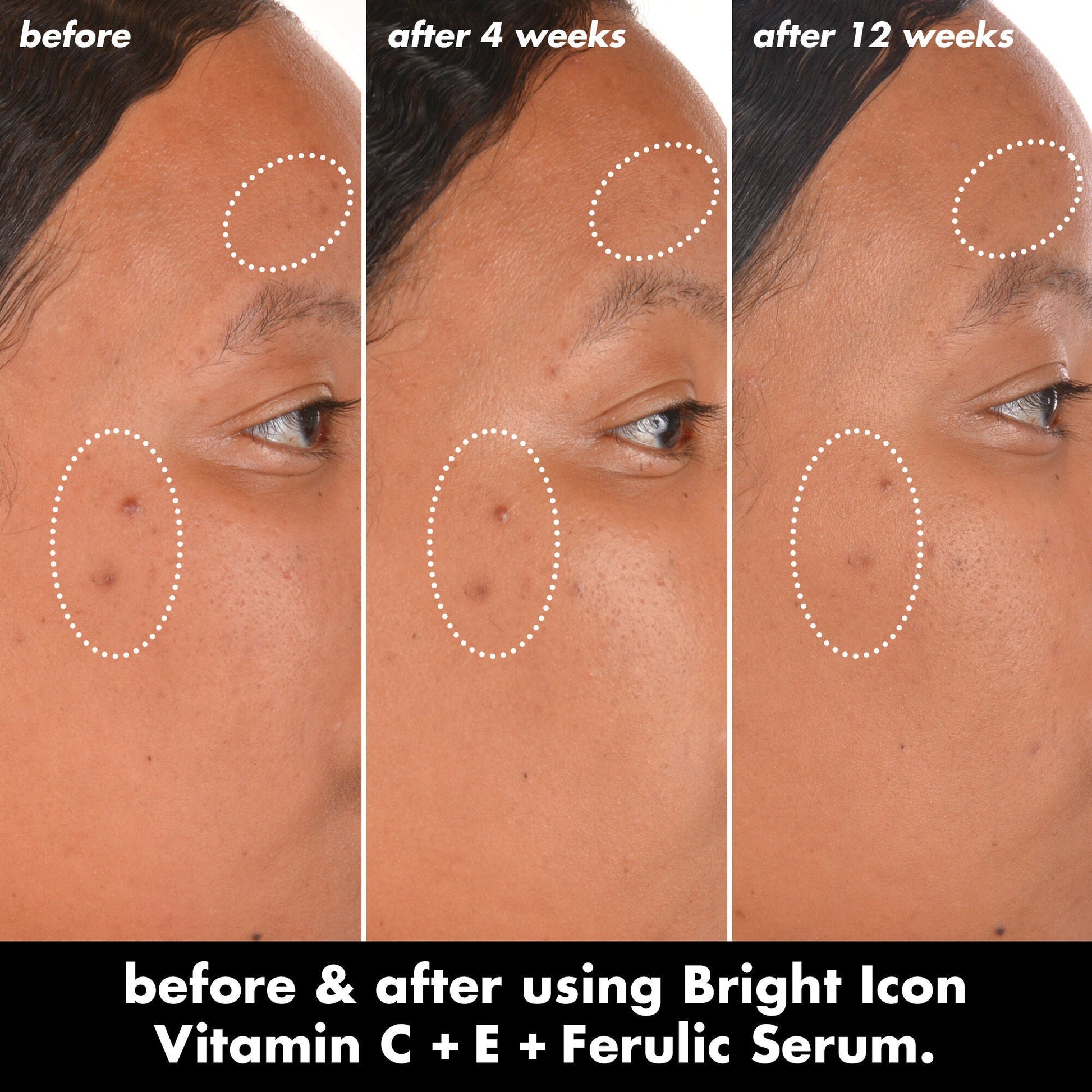 bright-icon-vitamin-c-e-ferulic-serum-n7 0226_EDU_BrightIconVitC_BA_Chanel_TRIPTYCH_c58f2fc8-209d-414f-9ba3-666a07a94887.jpg