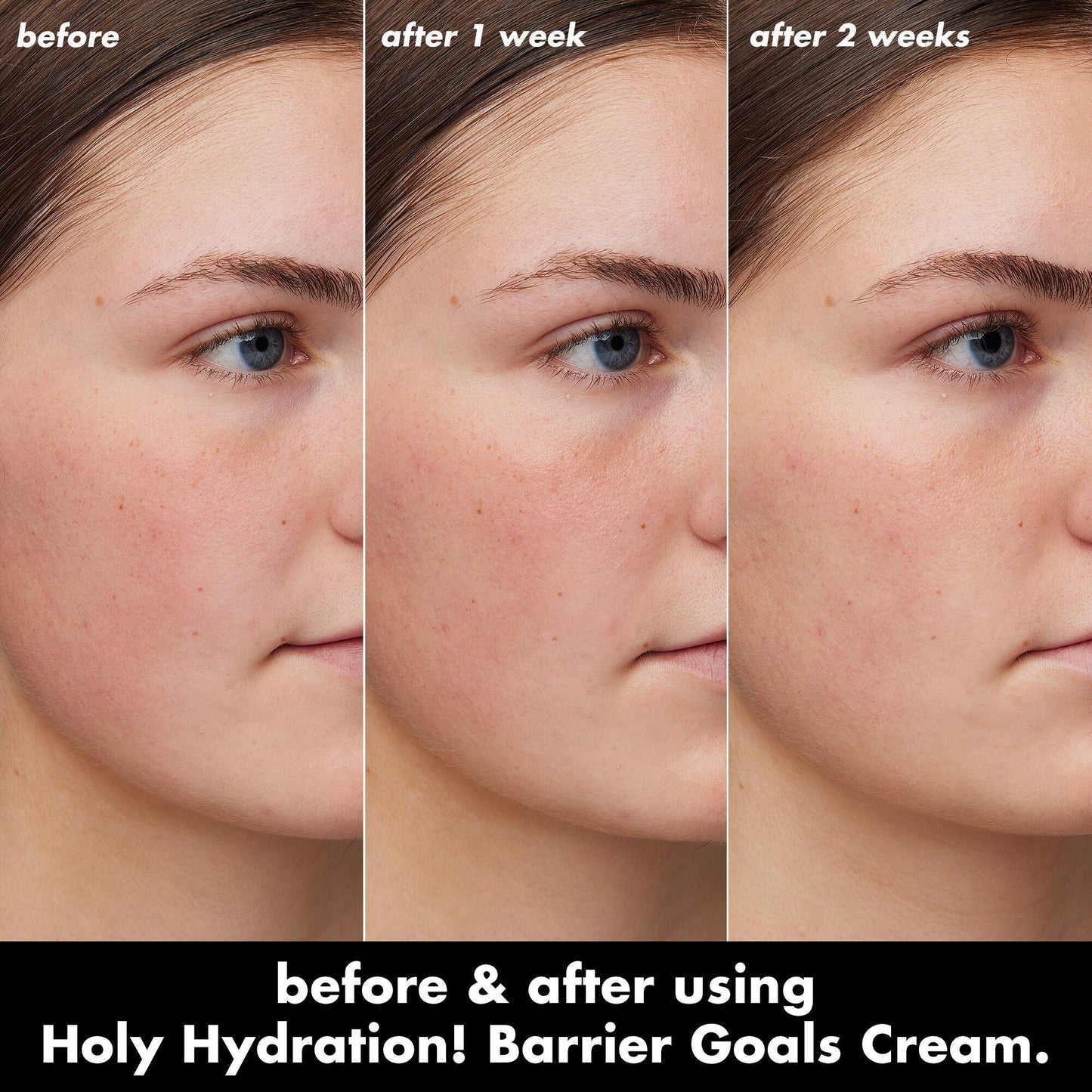 holy-hydration-barrier-goals-cream-mini-t1 0226_EDU_HHBarrierGoalsCream_B_A_Zoe_TRYPTICH_4f0e5b5d-35fb-4020-968e-244d4536afbd.jpg