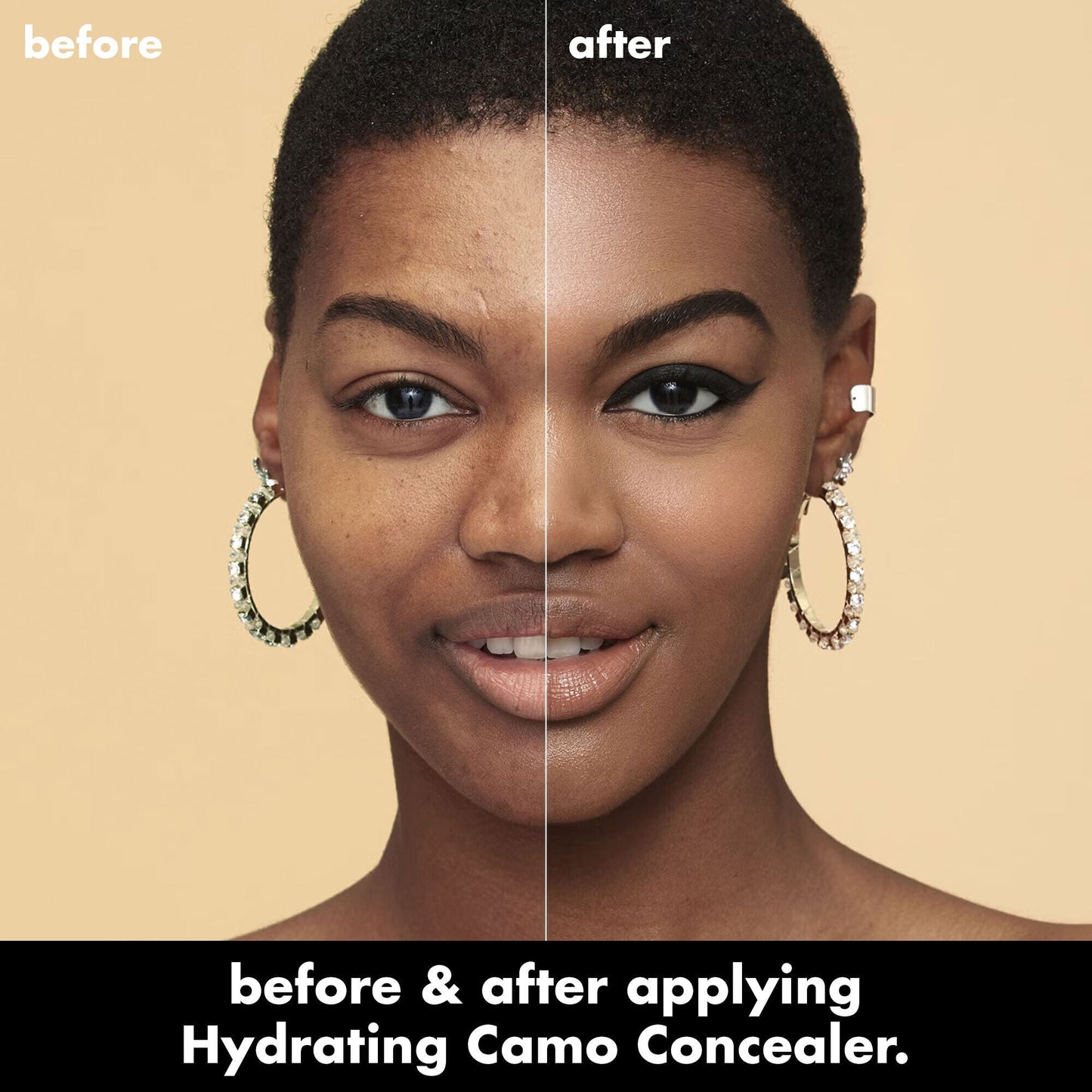 hydrating-camo-concealer-q0 0226_EDU_HydratingCamoConcelaer_BA_AshleyKaresh_20_1_d8499bbf-0e91-4173-b5e2-75127caf83a3.jpg