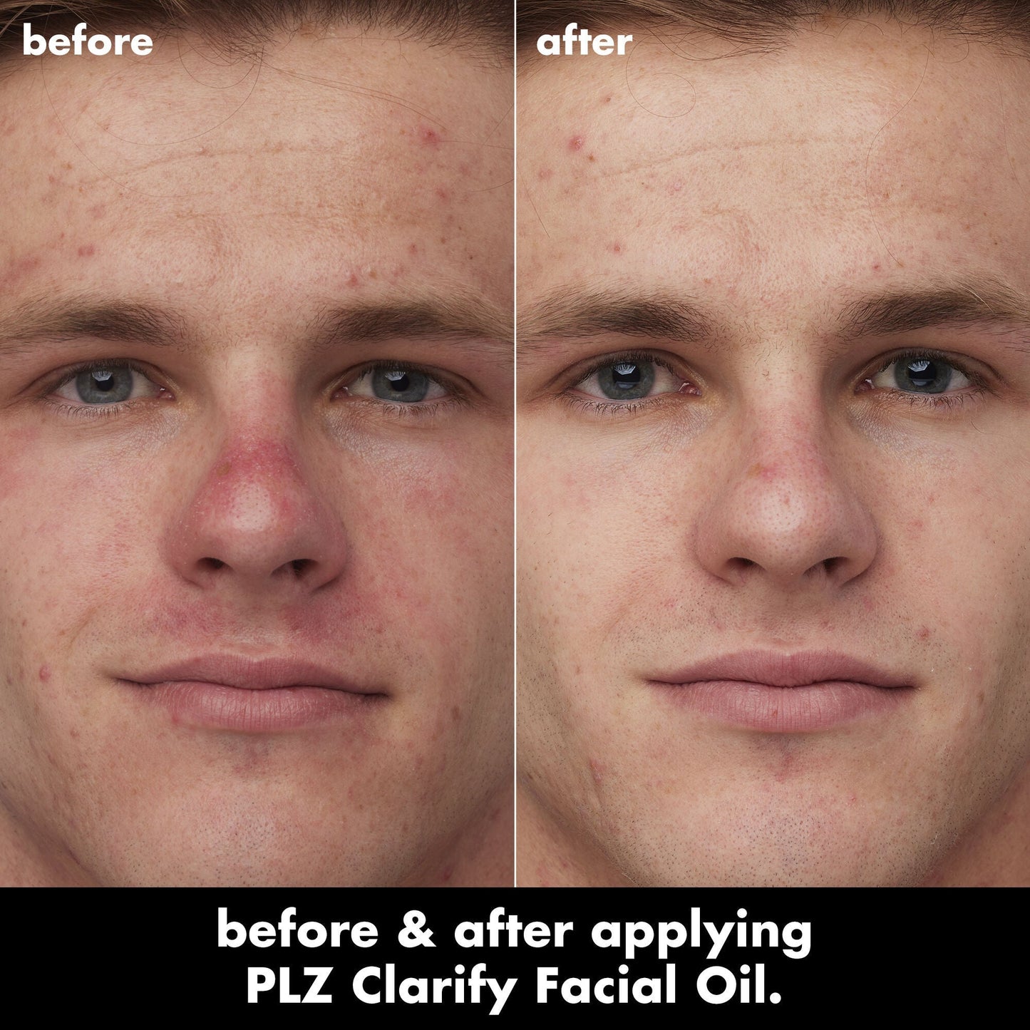 plz-clarify-facial-oil-a4 0326_EDU_PlzClarify_BA_Caleb.jpg