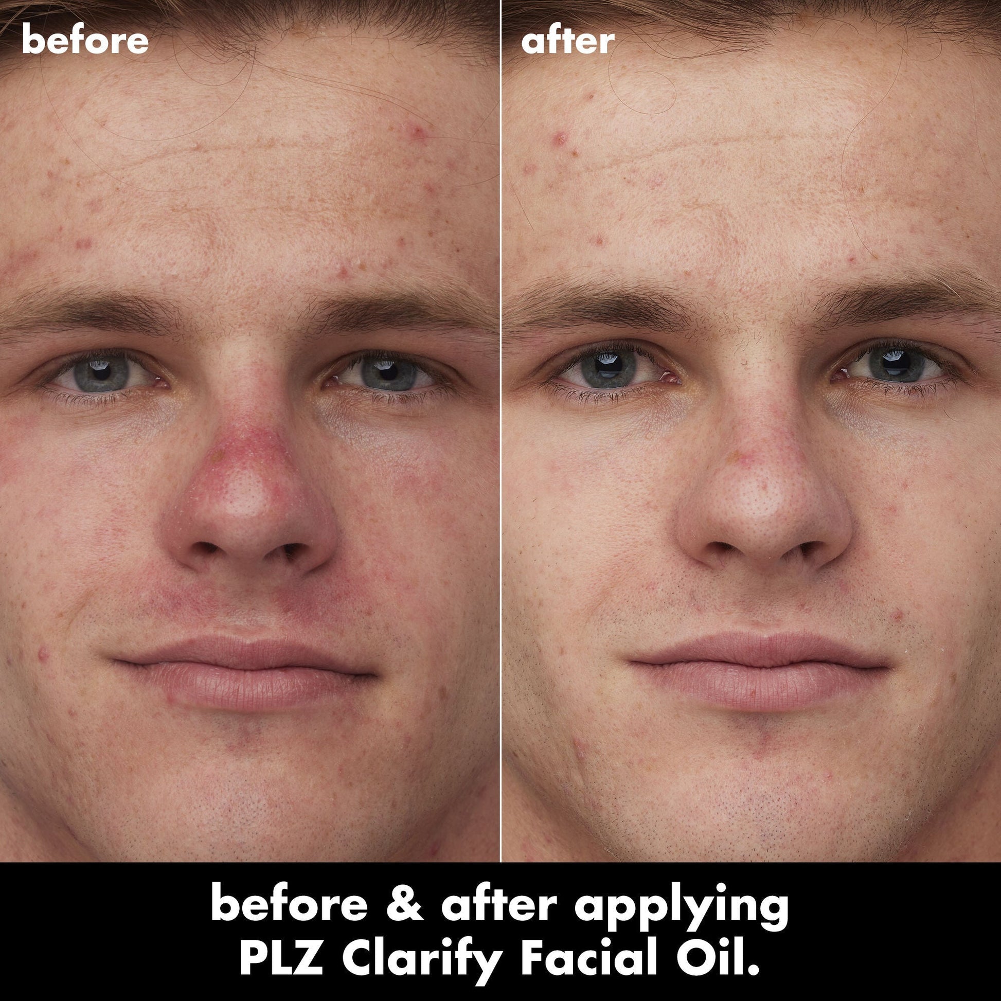 plz-clarify-facial-oil-a4 0326_EDU_PlzClarify_BA_Caleb.jpg