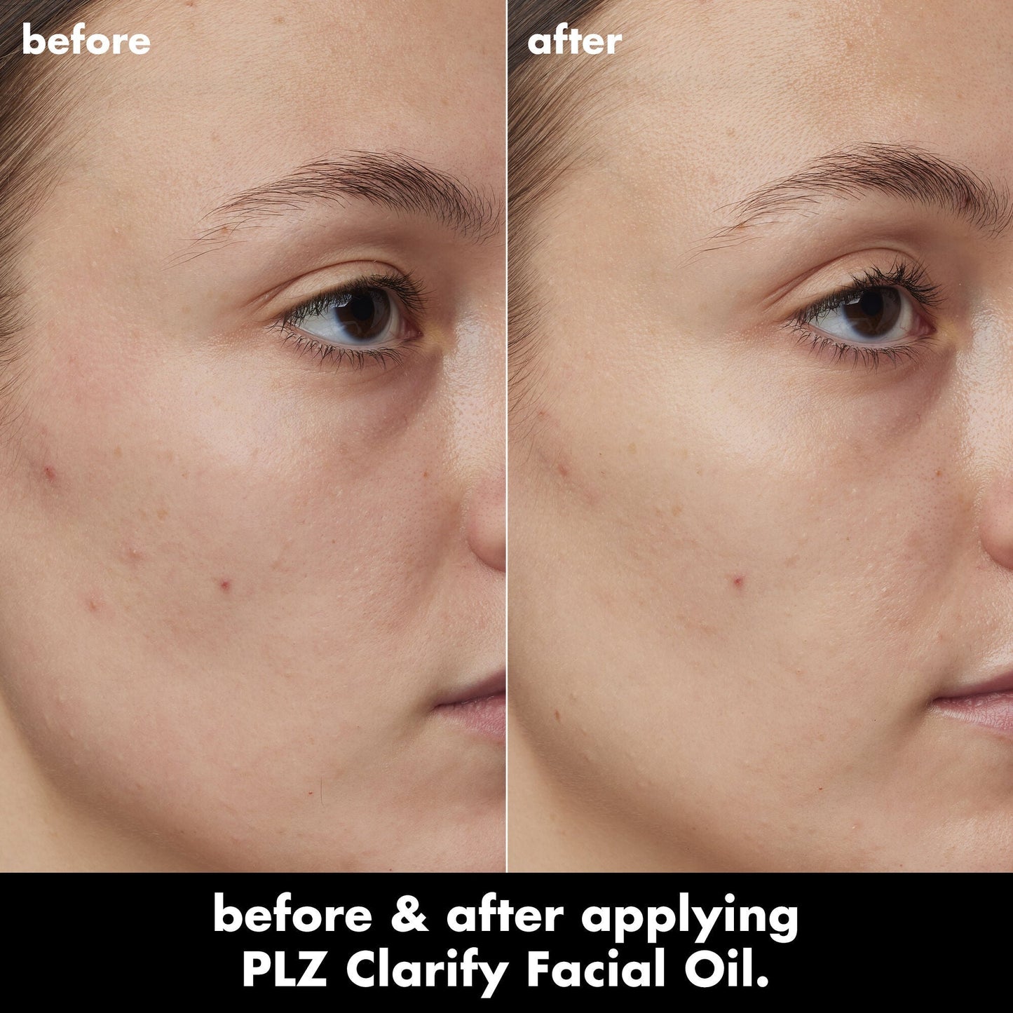 plz-clarify-facial-oil-a4 0326_EDU_PlzClarify_BA_Kelly.jpg