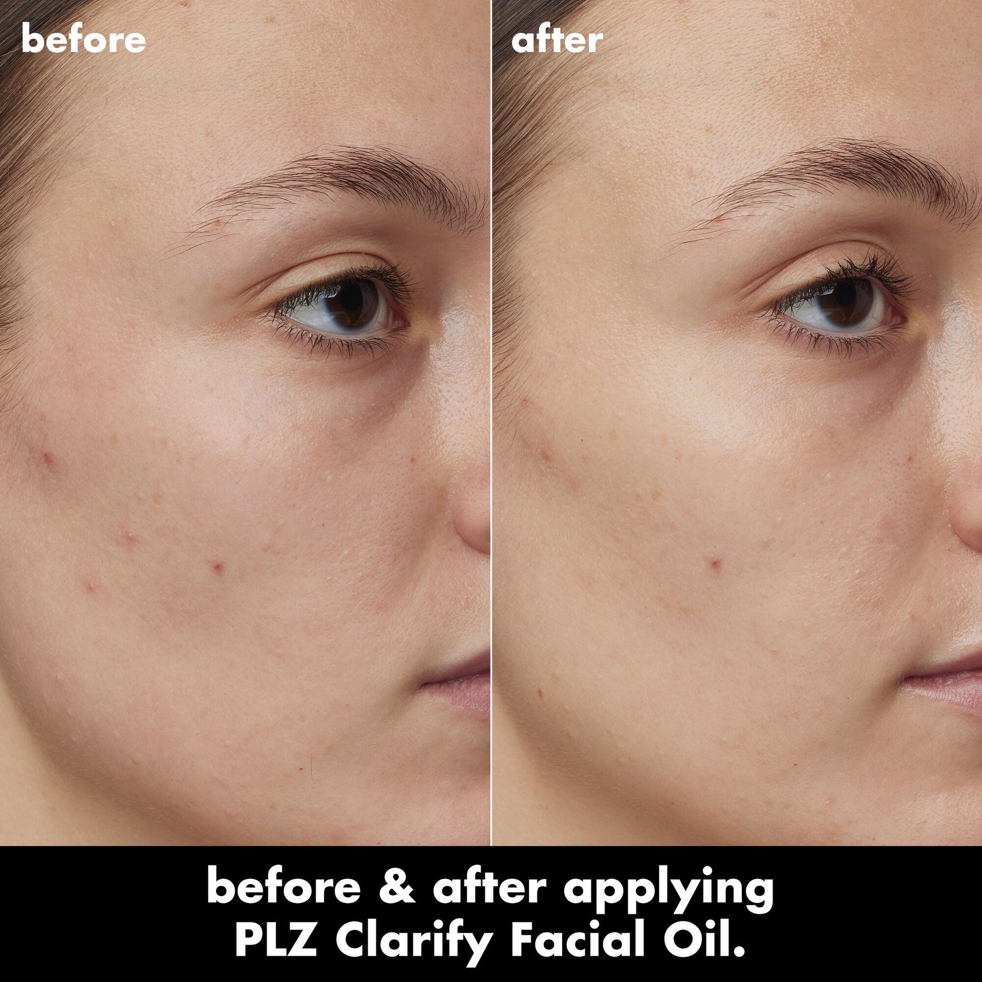 plz-clarify-facial-oil-a4 0326_EDU_PlzClarify_BA_Kelly.jpg