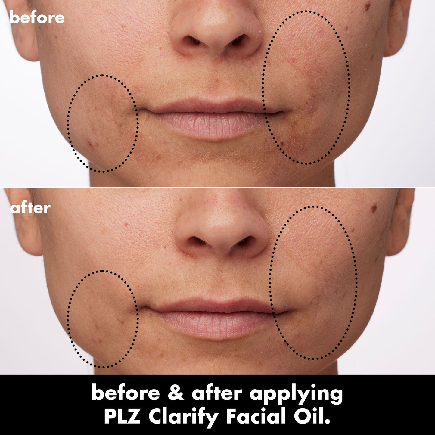 plz-clarify-facial-oil-a4 0326_EDU_PlzClarify_BA_Paula.jpg