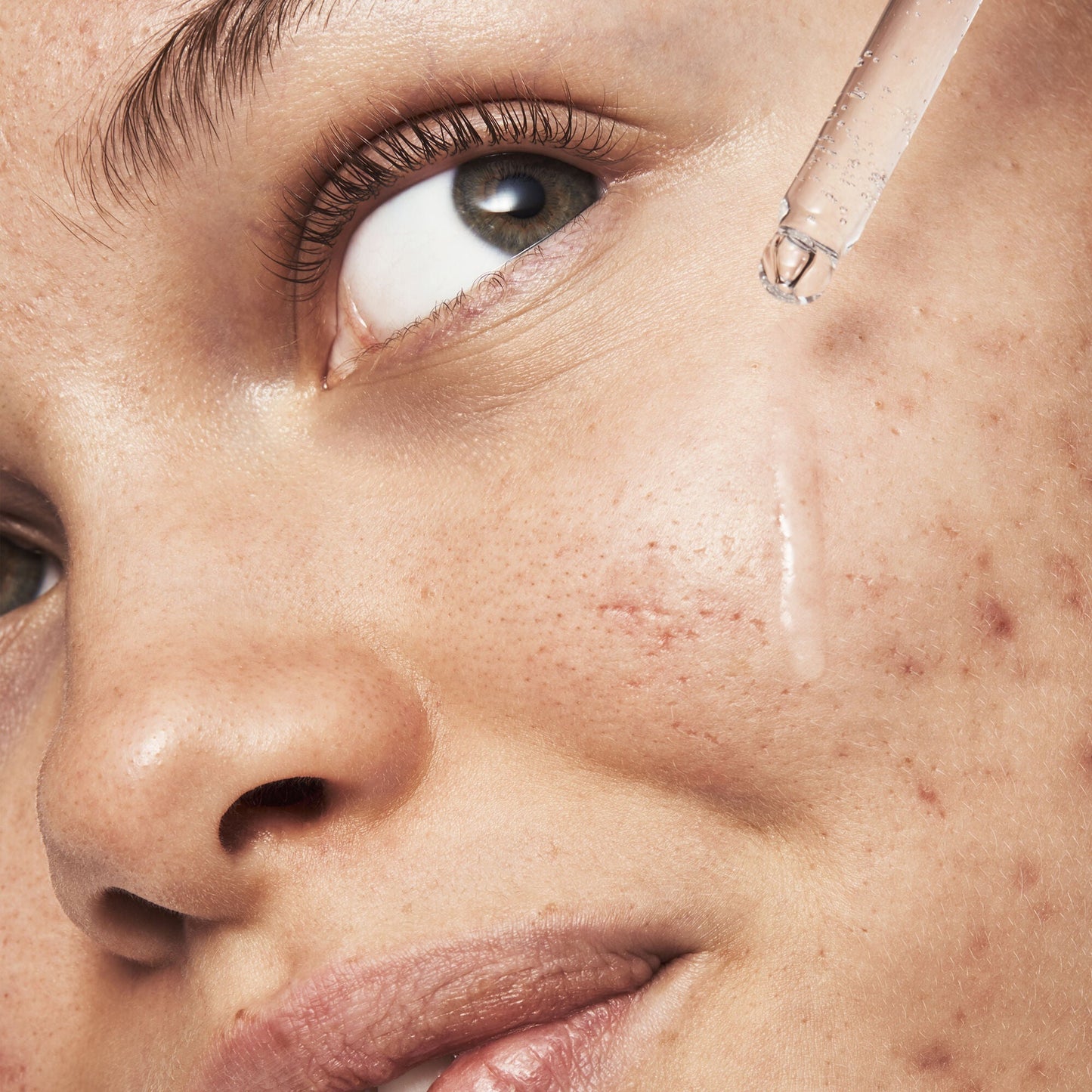 blemish-breakthrough-triple-acid-resurfacing-serum-a7 121321_Marley-Acne-Regimen_0254_FINAL_IGF.jpg