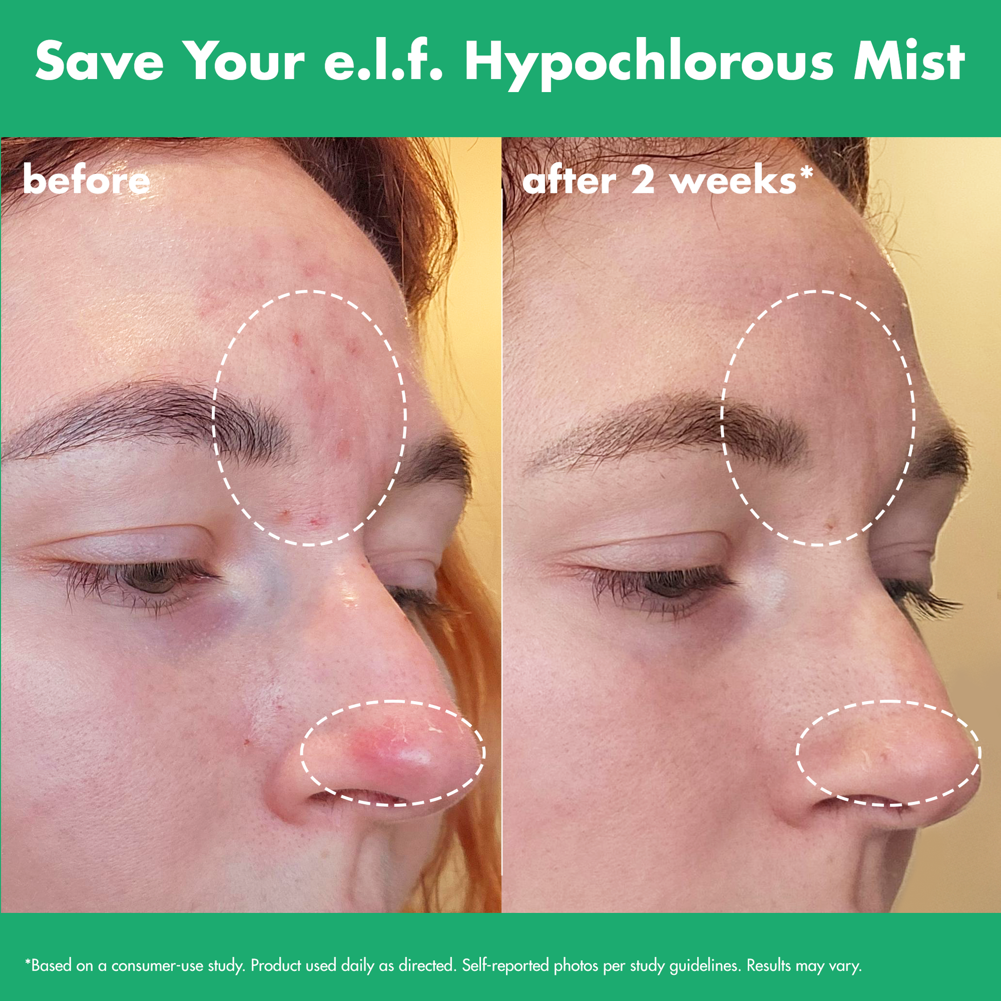 save-your-e-l-f-hypochlorous-mist-c9 FA26_EDUCATION_SAVEYOURELF_USAGE_BA1_WITHOUT_CLAIMS.png