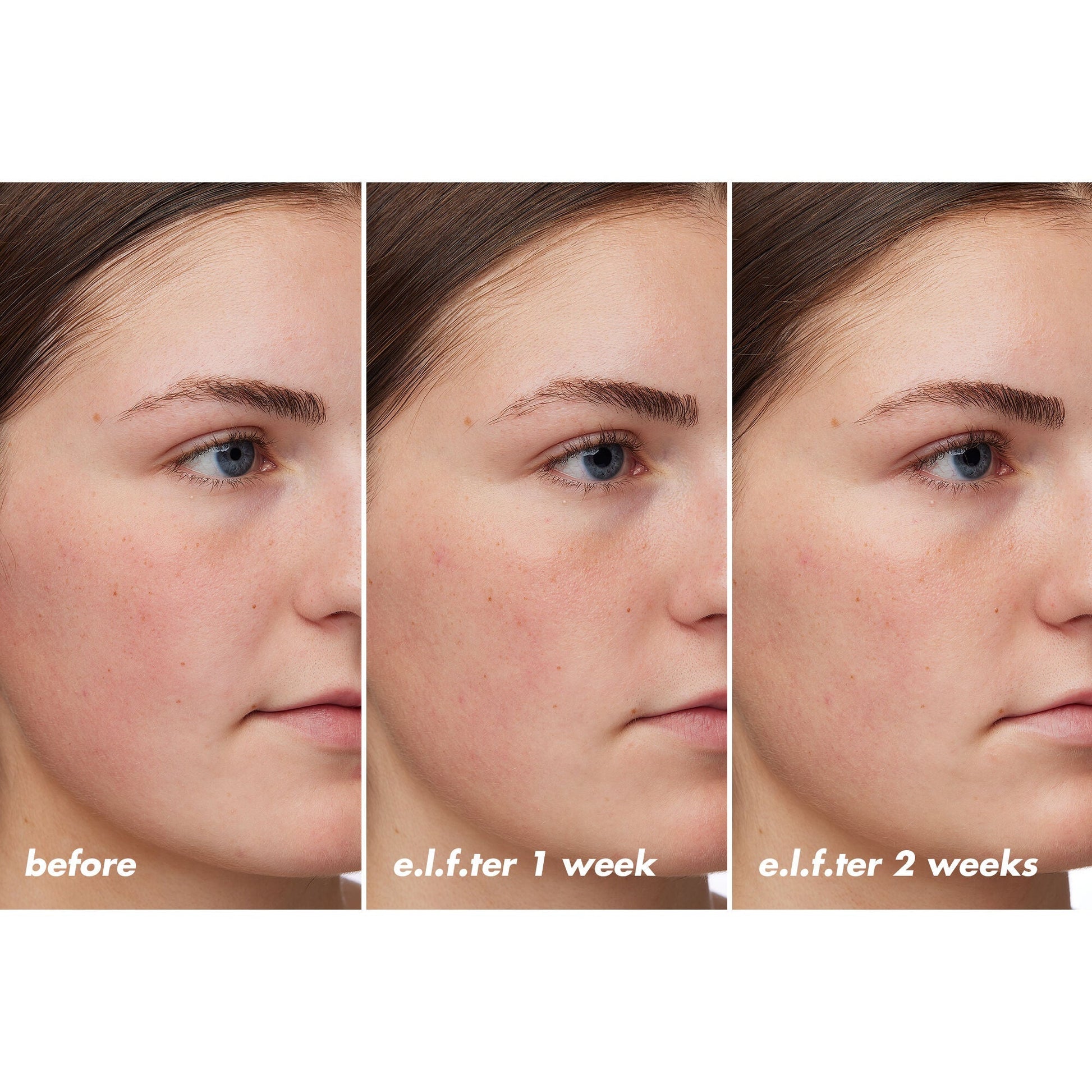 holy-hydration-barrier-goals-cream-regular-f0 XX26_EDUCATION_HH-BarrierGoals_B_A_Zoe_TRYPTICH_74c905bd-67bd-4b91-b633-2b01a8905cb8.jpg